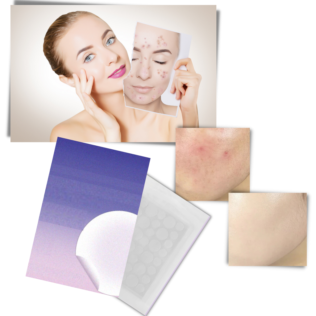 Confezione da 36 cerotti invisibili per l'acne - Ozerty