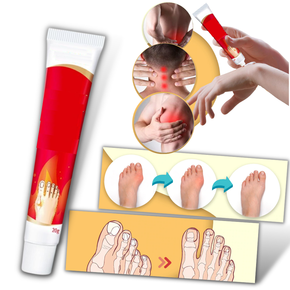 Crema antinfiammatoria per l'alluce valgo - Ozerty