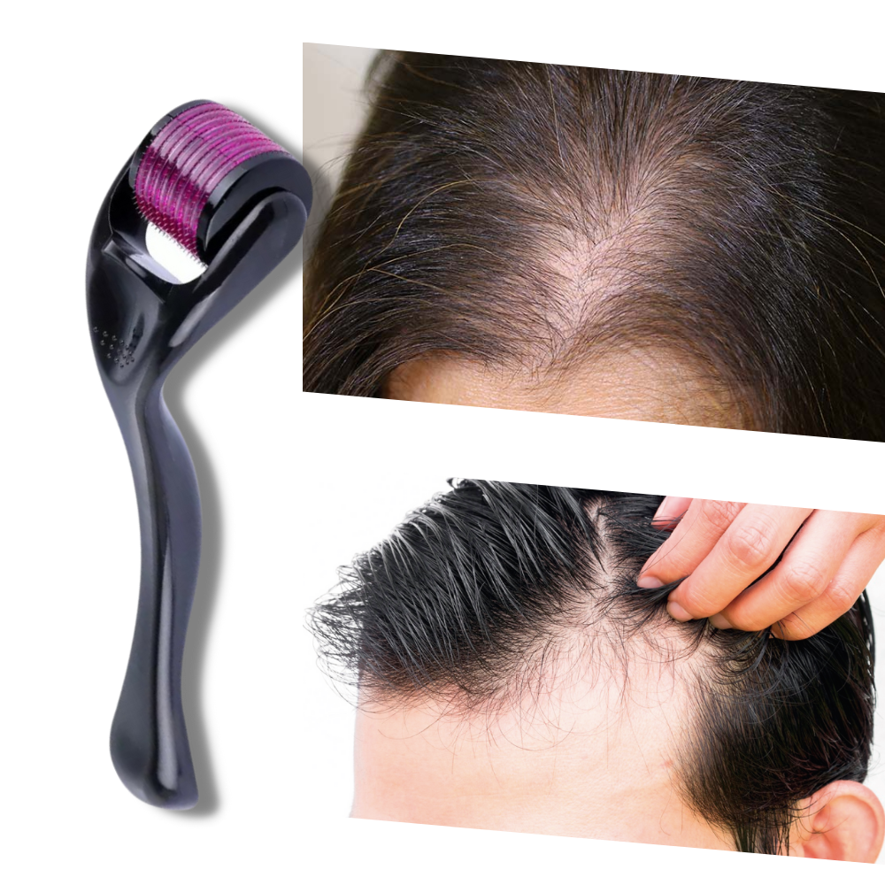 Rullo Derma per la crescita di capelli e barba - Ozerty
