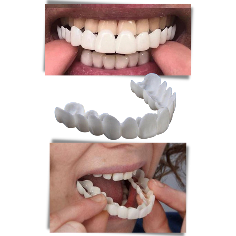 Copertura dentale del sorriso perfetto - faccette confortevoli - Ozerty